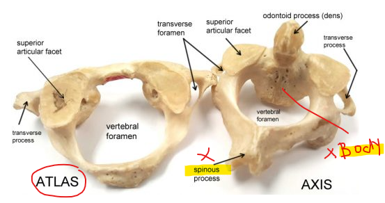 <ul><li><p>Articulates with the SKULL on the occipital condyles. </p></li><li><p>It has 2 lateral masses connected by anterior arch and posterior arch to form a irregular ring. </p></li><li><p>no body and no spine </p></li></ul><p></p>