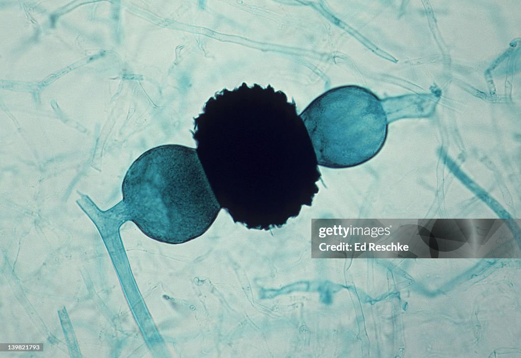 <p>What is this and how many spores does it have?</p>