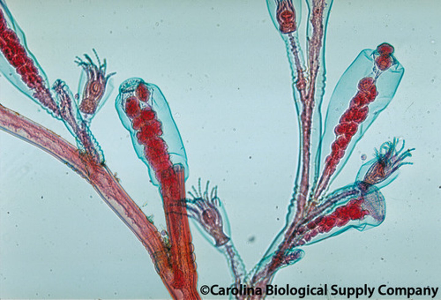 <p>What structure is being pointed to? (top of gonotheca/ gonagium)</p>