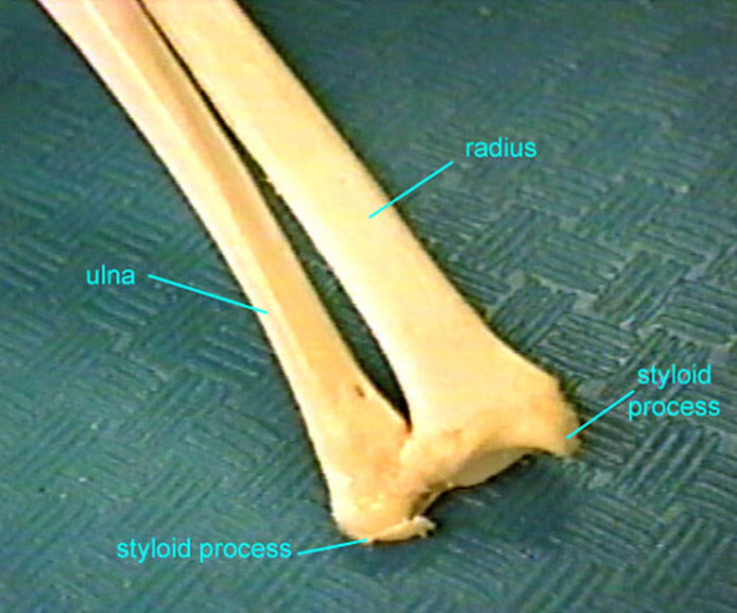 <p>distal</p>