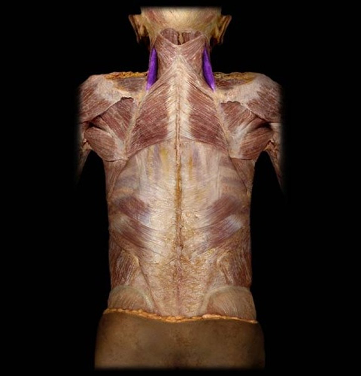 <p>Origin: Transverse processes of the C1-C4 vertebrae.<br>Insertion: Medial border of the scapula between spine and superior angle.<br>Action: elevates and adducts scapula, bends neck laterally</p>