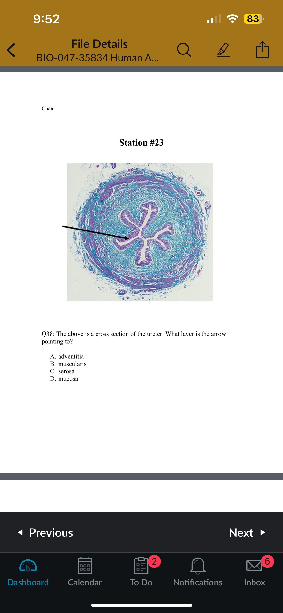 <p>Q38: The above is a cross section of the ureter. What layer is the arrow pointing to</p>