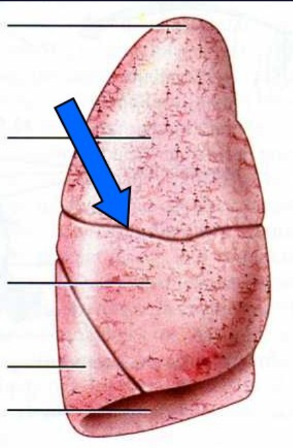 The groove that separates the middle lobe from the superior lobe in the right lung.