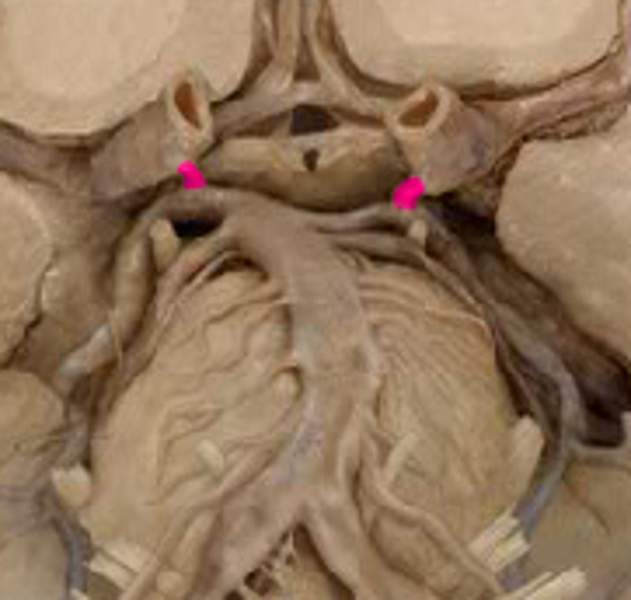 <p>The artery of the Circle of Willis that transports <br>blood from the internal carotid artery to the <br>posterior cerebral artery is the</p>