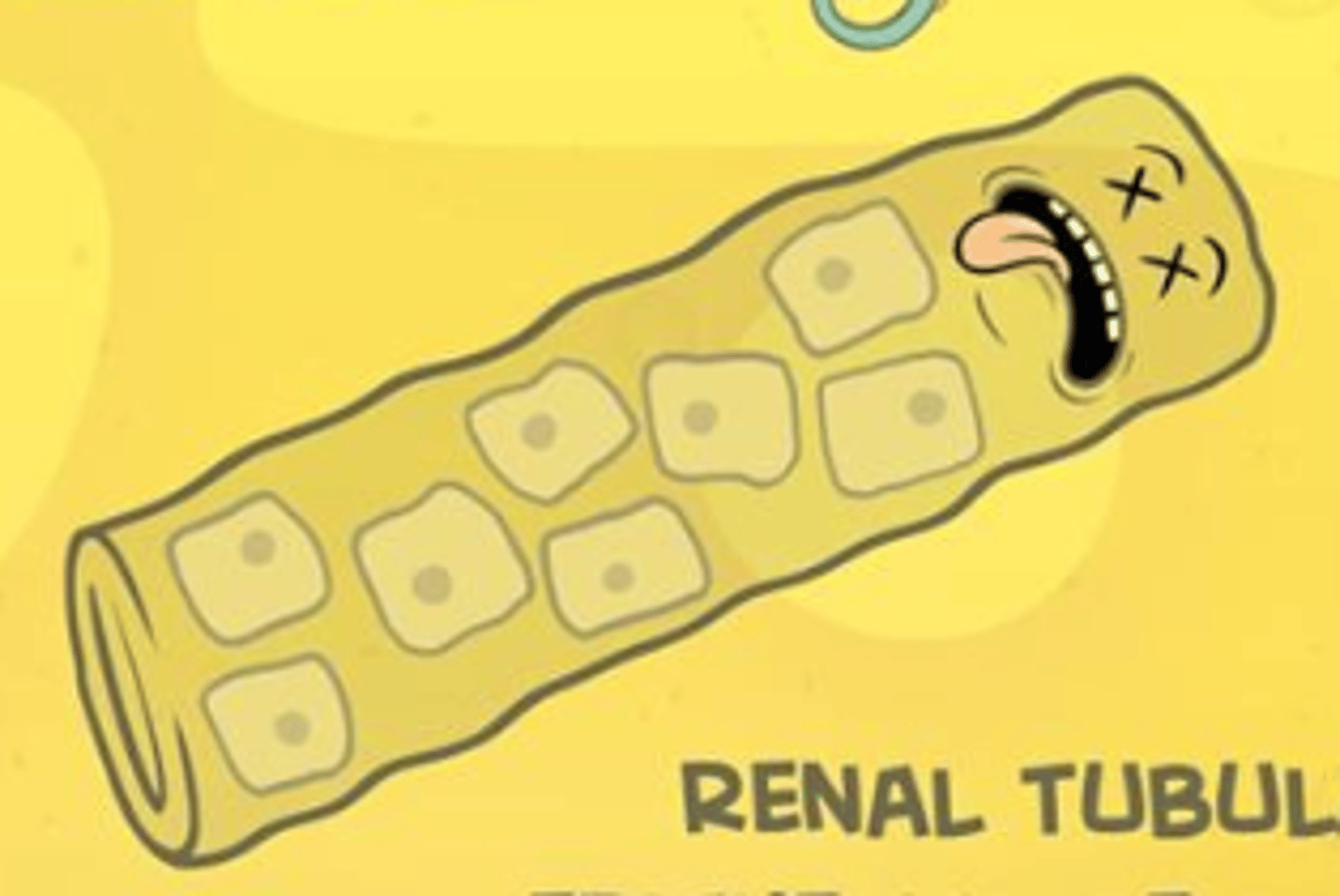 <p>acute tubular necrosis (ATN)</p>