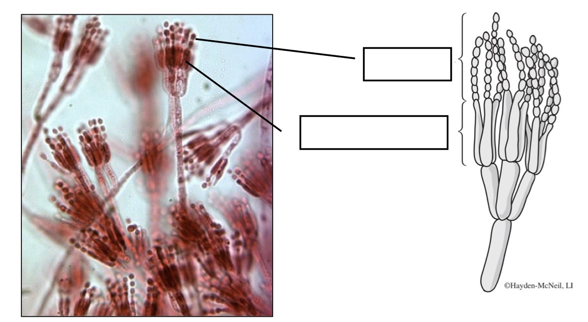 <p>Label conidia and conidiophores</p>