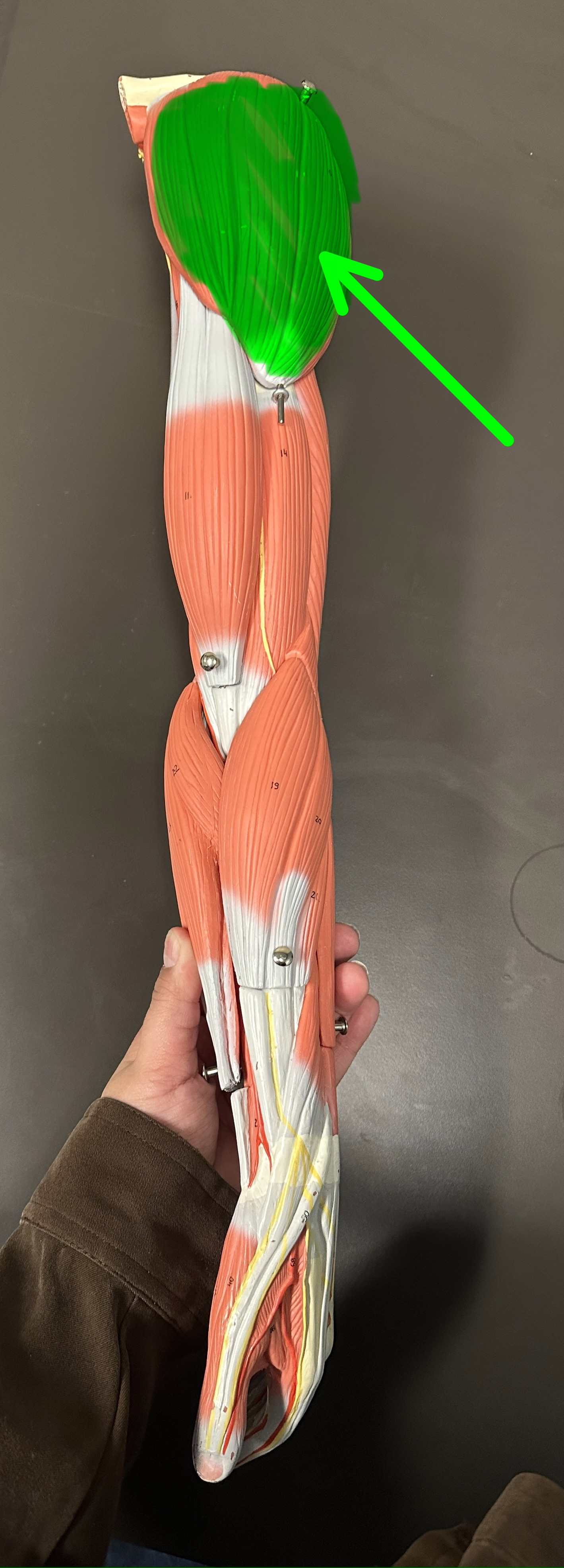 <p>What is the highlighted structure</p>