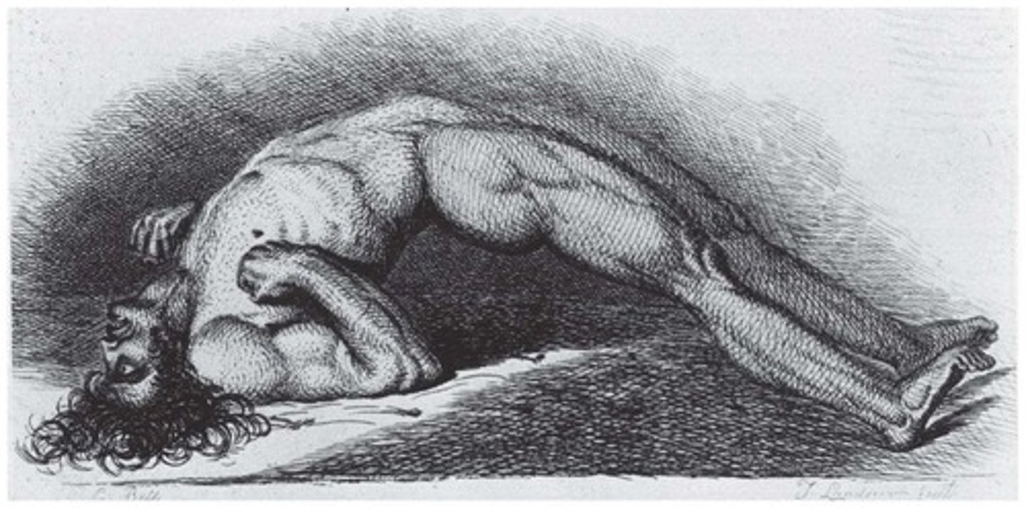 <p>Causing tetanus, characterized by muscle spasms and lockjaw.</p>