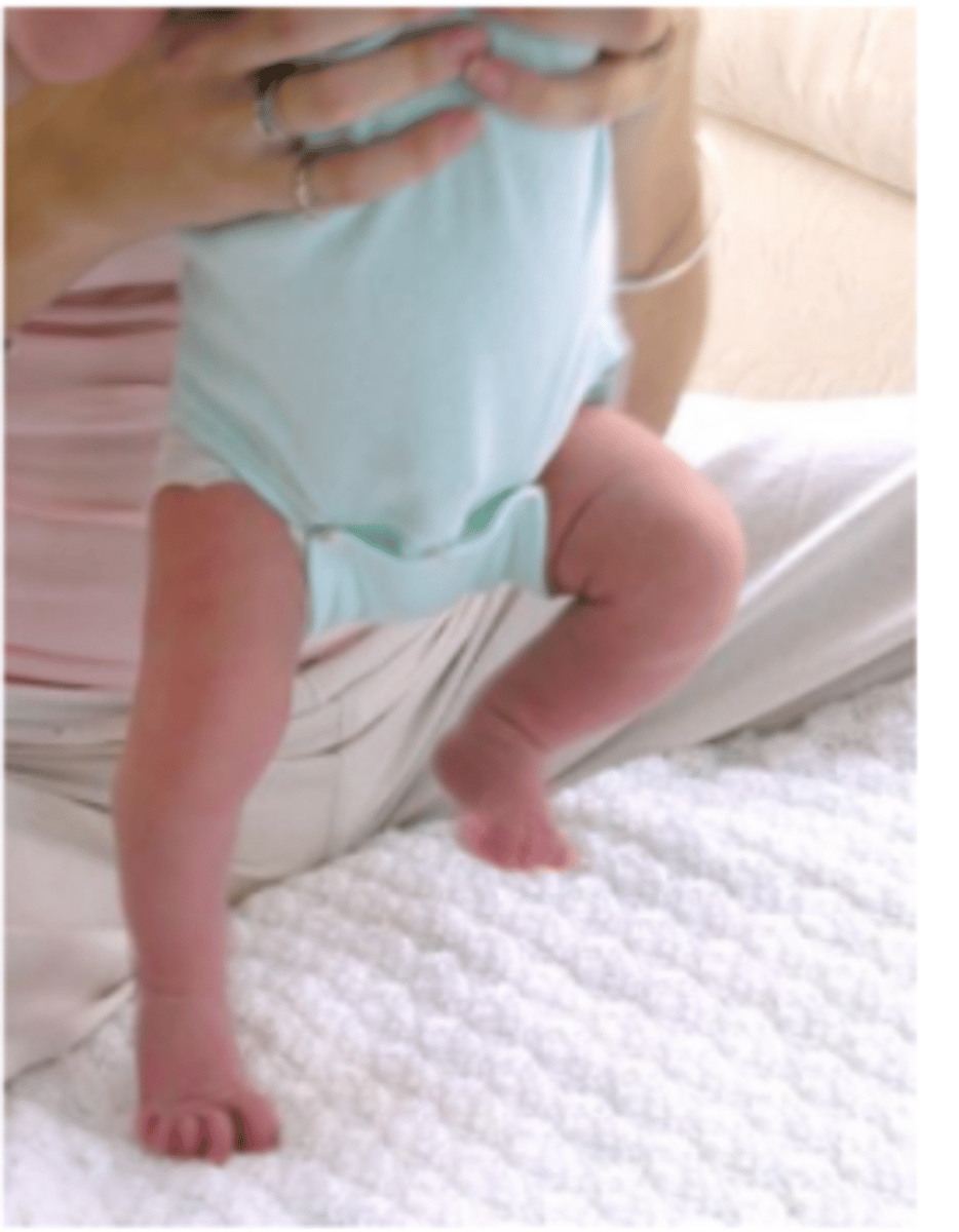 <p>Hold the infant upright under the arms, close to a table.</p><p>Let the dorsal "top" of foot touch the underside of the table.</p><p>Note flexing of hip and knee, followed by extension at the hip, to place foot on table</p><p>Reflex appears at 4 days after birth</p>