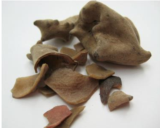 <p>Viêm ruột mãn tính</p>