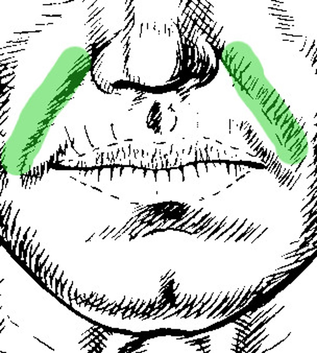 <p>anterior fold of the cheek that descends from the nose to the corner of the lips</p>