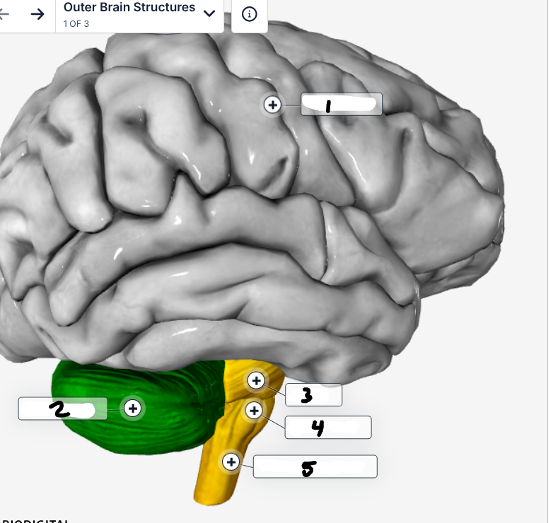 <p>Label the image</p>