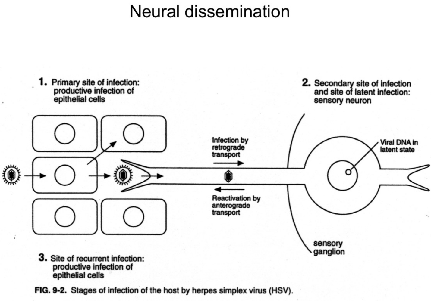 <p><span>What happens to HSV after it reaches the sensory ganglia?</span></p>