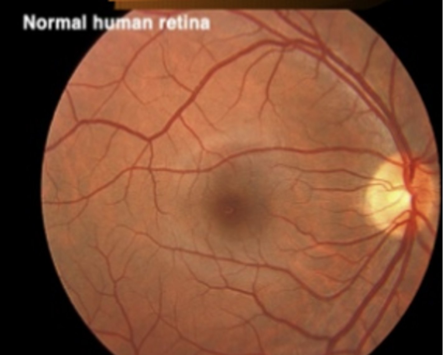 DCC Exam 2 Slides Flashcards Knowt