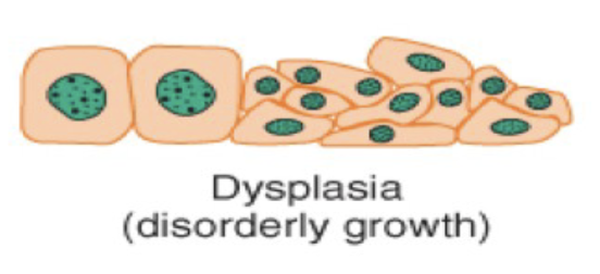 <p>Dysplasia (cellular adaptation) is  ____ cell ____.</p>