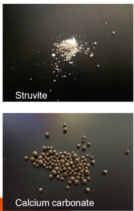 <ul><li><p>Male llamas and alpacas are prone to urethral blockage due to their genito-urinary anatomy </p></li><li><p>types of Uroliths: </p><ul><li><p>Phosphatic (struvite, apatite, amorphous magnesium calcium phosphate) </p><ul><li><p>caused by high-grain diets and low calcium to phosphorus ratio</p></li></ul></li><li><p>calcium salts: less common but can occur </p></li><li><p>silica and oxalates: associated with certain forages or diets </p></li></ul></li><li><p>clinical signs: </p><ul><li><p>complete blockage: </p><ul><li><p>bladder rupture: abdominal distention, pain, and shock </p></li><li><p>inability to urinate, severe discomfort and systemic illness </p></li></ul></li><li><p>incomplete blockage </p><ul><li><p>stranguria (difficulty urinating) </p></li><li><p>prolonged urination posture </p></li><li><p>urine dribbling or blood-tinged urine </p></li><li><p>depression, tooth grinding (sign of pain) </p></li></ul></li></ul></li><li><p>diagnosis: </p><ul><li><p>physical exam: palpation of a distended bladder or abdominal pain </p></li><li><p>imaging: ultrasound or radiography to identify uroliths </p></li><li><p>urinalysis: blood, crystals, or signs of infection </p></li></ul></li></ul><p></p>