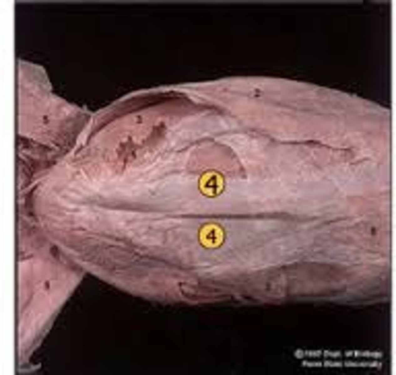 <p>name this muscle</p>