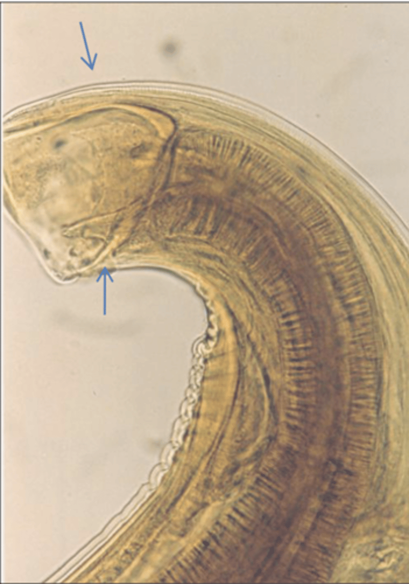 <p>What is this parasite? What characteristic/s did you use to identify it?</p>