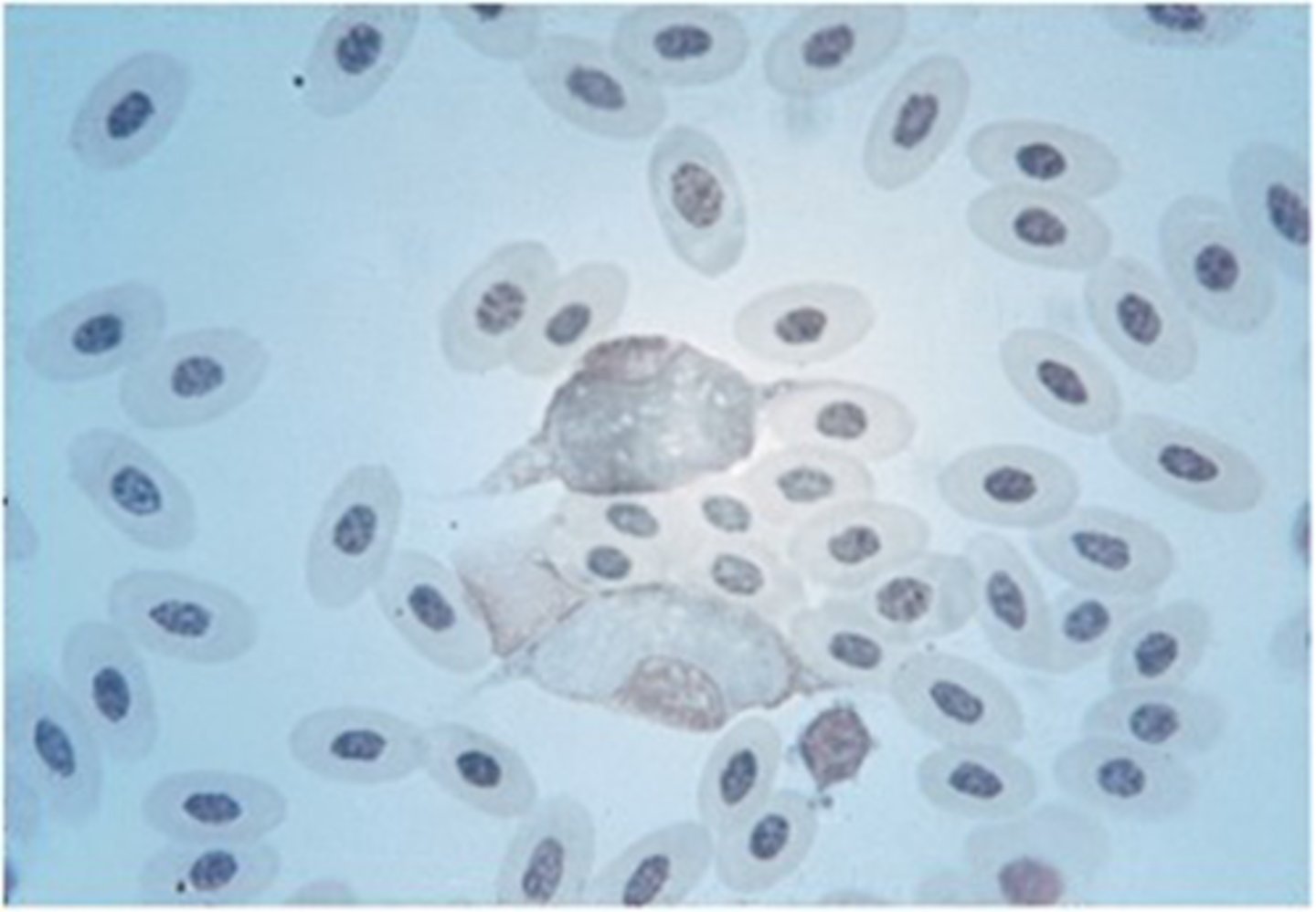 <p>Raptors play host to this protozoan parasite seen within white blood cells. This protozoan is:</p>