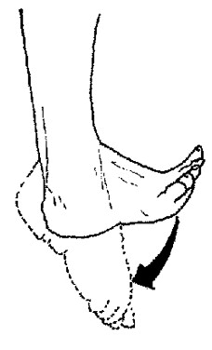 <p>Depressing the foot, pointing the toes downward.</p>