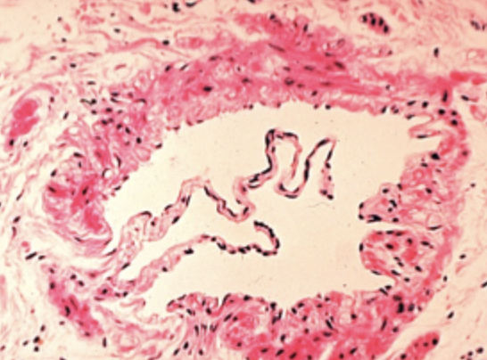 <p>What is this image?</p>