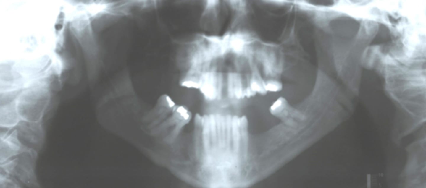 <p>What are the problems in this panoramic image?</p>