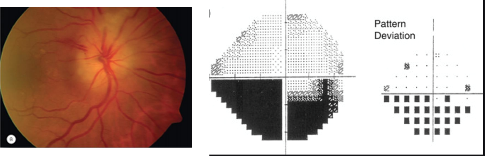 <p>Altitudinal </p>