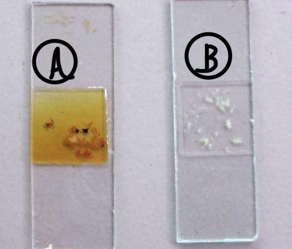 <p>A- what is the method of examination used here</p><p>B-identify the technique</p><p>C- Identify A&amp;B in the picture and used for what</p><p>D- explain the procedure</p>