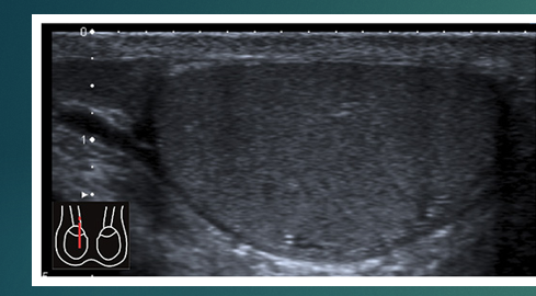 <p>list the 2 pieces of anatomy</p>