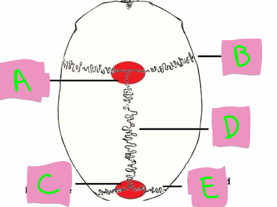<p>What’s A-E?</p>