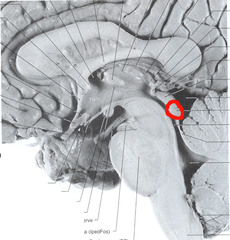 <p>part of the midbrain involved in auditory processing</p>