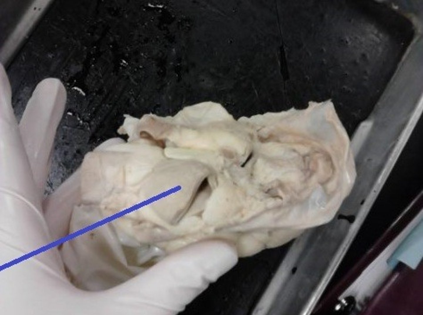 <p>Identify the blood vessel that carries blood from the left ventricle to the rest of the body</p>