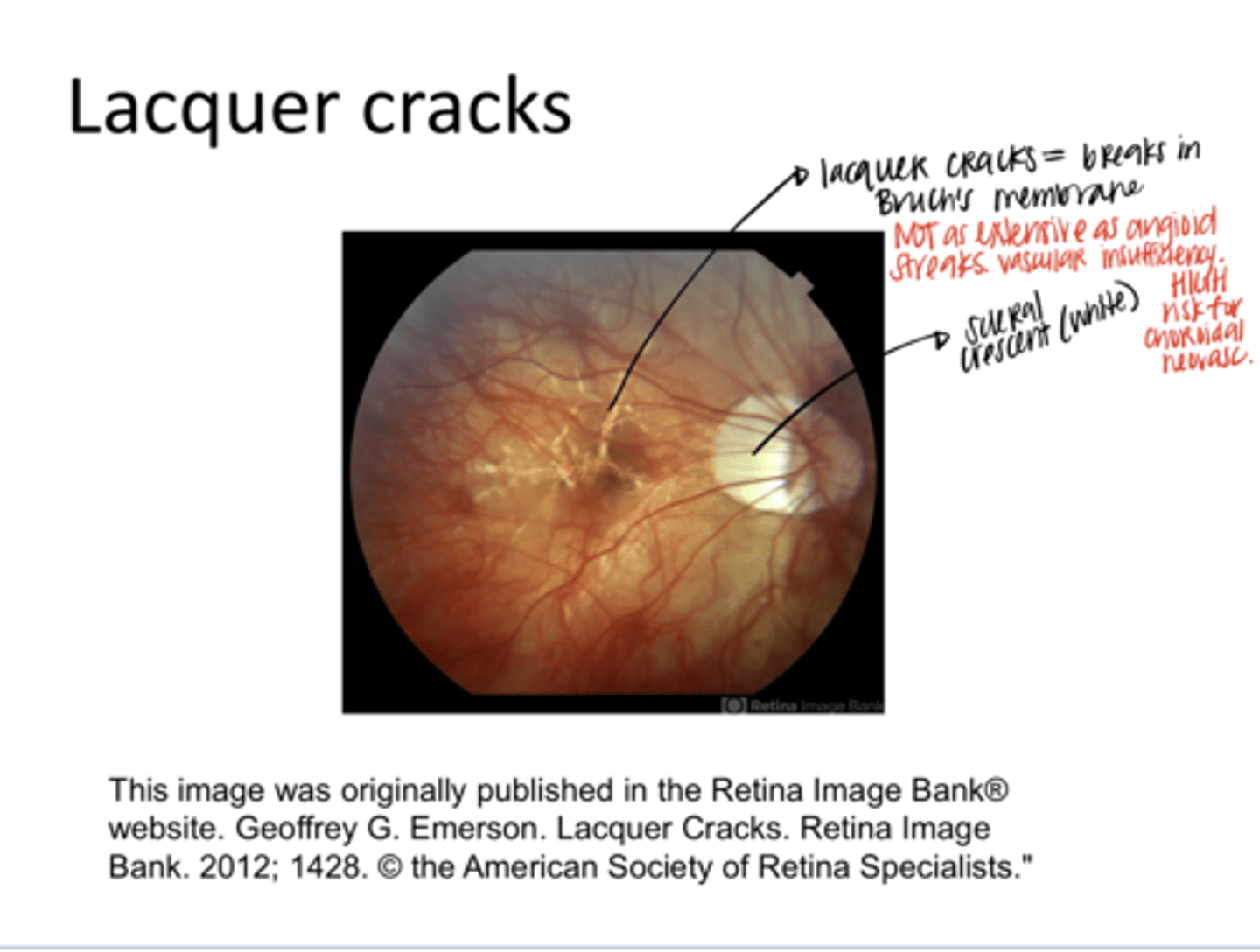 <p>What are lacquer cracks?</p>