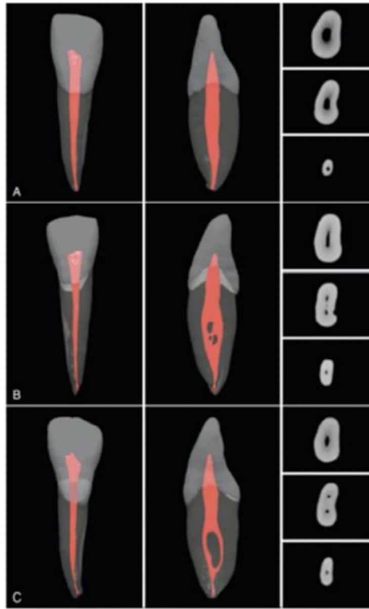 <p>mandibular lateral (longer/thicker), mandibular central</p>