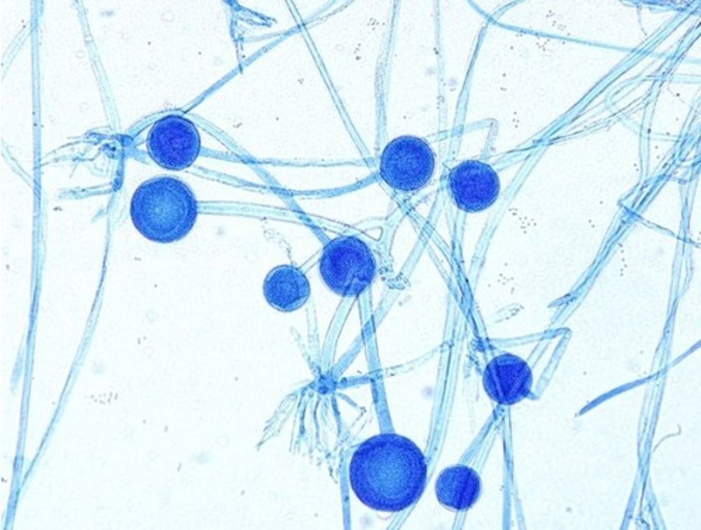<p>• Rhizoids and</p><p>unbranched</p><p>sporangiophores</p><p>• Sporangiophore = sac of</p><p>spores</p>