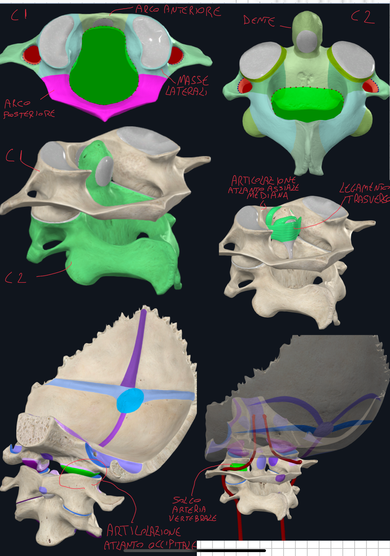 <p>Vertebre Atipiche:</p><ul><li><p>C1 o Atlante</p></li><li><p>C2 o Epistrofeo o Asse</p></li><li><p>Sono diverse perché sono specializzate per consentire i movimenti della testa, articolandosi con il cranio.</p></li></ul><p>ATLANTE C1:</p><ul><li><p>Nome dal gigante mitologico che sosteneva il cielo (qui sostiene la testa)</p></li><li><p>Non ha il corpo vertebrale</p></li><li><p>E’ formato da due archi ossei (anteriore e posteriore) separati da due masse laterali (destra e sinistra)</p></li><li><p>Le masse laterali rappresentano la parte più robusta di questa vertebra e servono da punto di articolazione con l’Osso Occipitale e C2</p></li><li><p>Archi e Masse delimitano un ampio Foro Vertebrale che accoglie midollo spinale e il processo dell’epistrofeo (dente dell’epistrofeo, importante per la rotazione della testa)</p></li><li><p>L’origine Embriologica del dente spiga perché C1 non ha il corpo → durante lo sviluppo, la parte che dovrebbe formare il corpo di C1, si fonde con la parte superiore del corpo di C2, per cui il dente dell’epistrofeo corrisponde al corpo dell’atlante, ma fa parte di C2.</p></li><li><p>Sulla superficie superiore dell’arco posteriore dell’atlante troviamo il solco per l’arteria vertebrale, che sale lungo il tratto cervicale della colonna attraverso i fori trasversali e poi gira sull’arco dell’atlante per entrare nel cranio attraverso il forame magno raggiungendo la fossa cranica posteriore per contribuire alla vascolarizzazione cerebrale.</p></li></ul><p>EPISTROFEO C2:</p><ul><li><p>Caratteristica principale è il dente che sporge sul margine superiore del suo corpo</p></li><li><p>Il dente ha una faccetta articolare anteriore per articolarsi con l’arco anteriore e una posteriore per articolarsi con il legamento trasverso</p></li></ul><p></p>