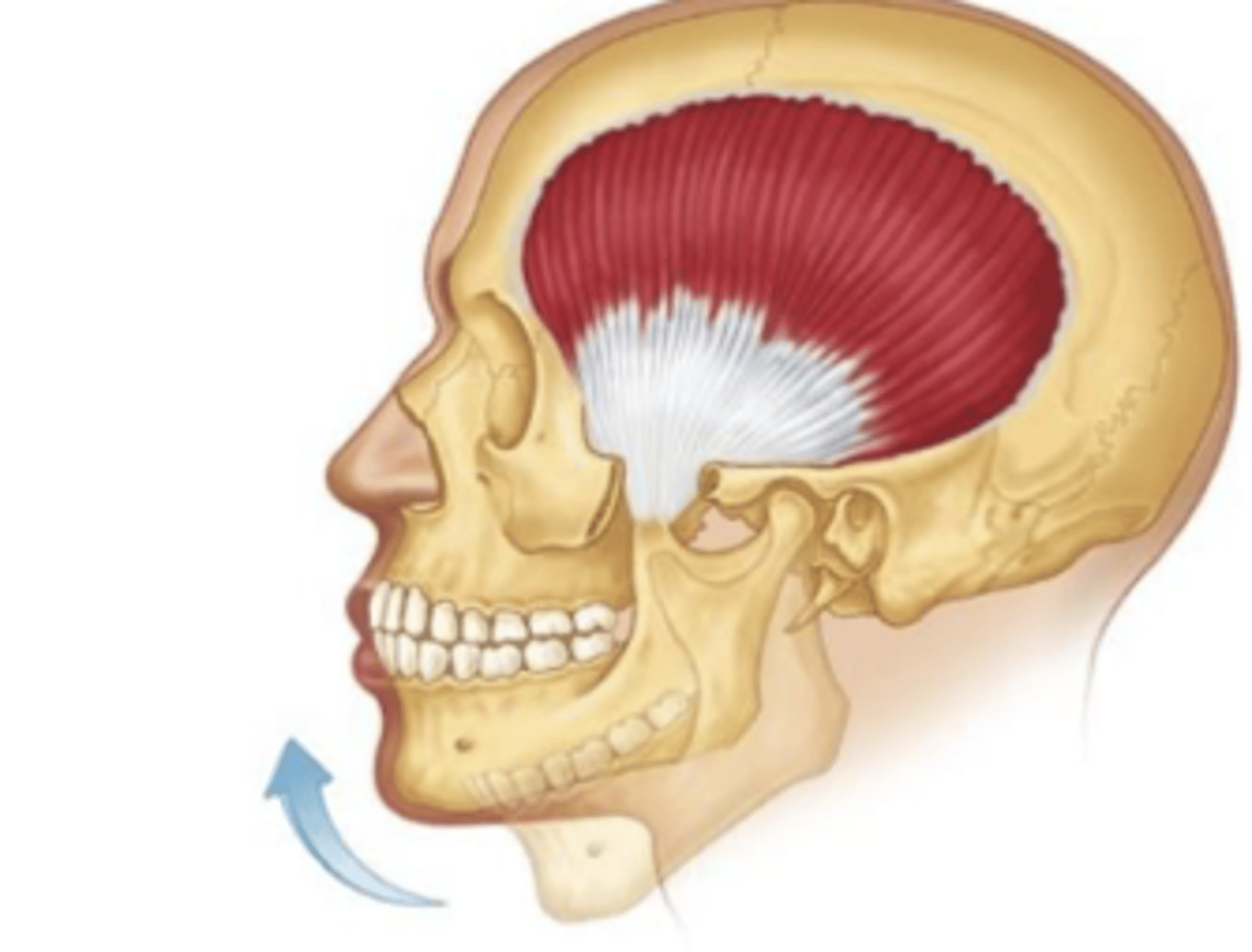 <p>origin: temporal lines </p><p>insertion: coronoid process </p>