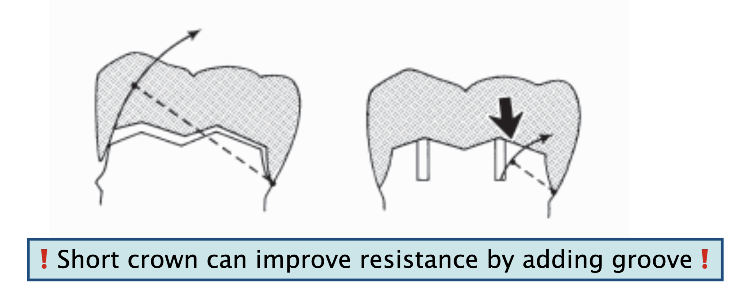 <p>these interfere w rotational movement (tipping) of the crown and thereby subject additional areas of the luting agent to compression&nbsp;</p>