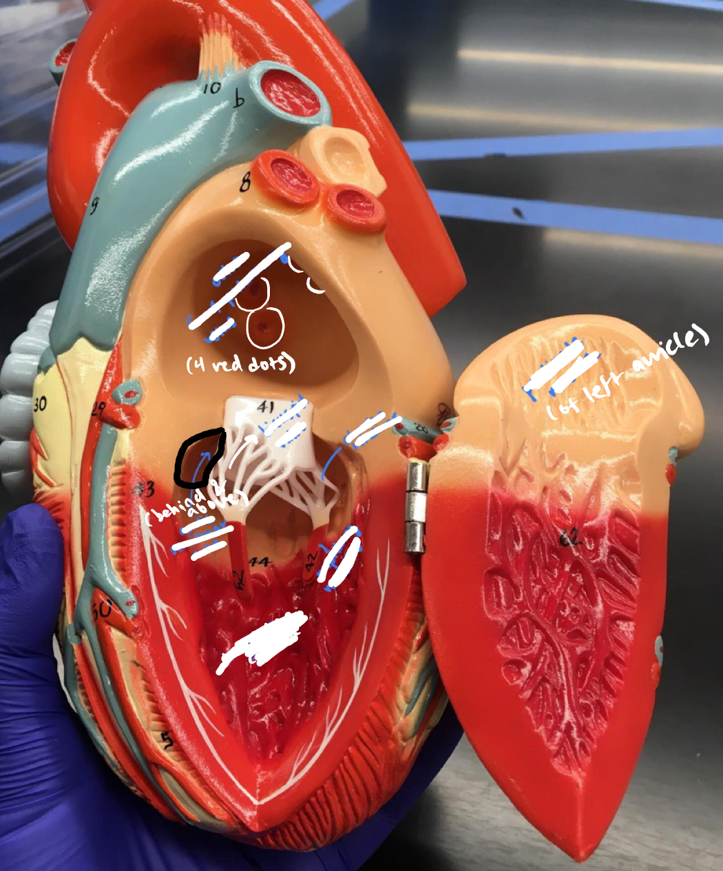 <p>The empty space behind and above the bicuspid valve</p>