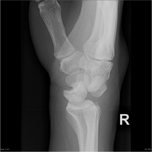 <p>Describe the abnormality demonstrated.</p>