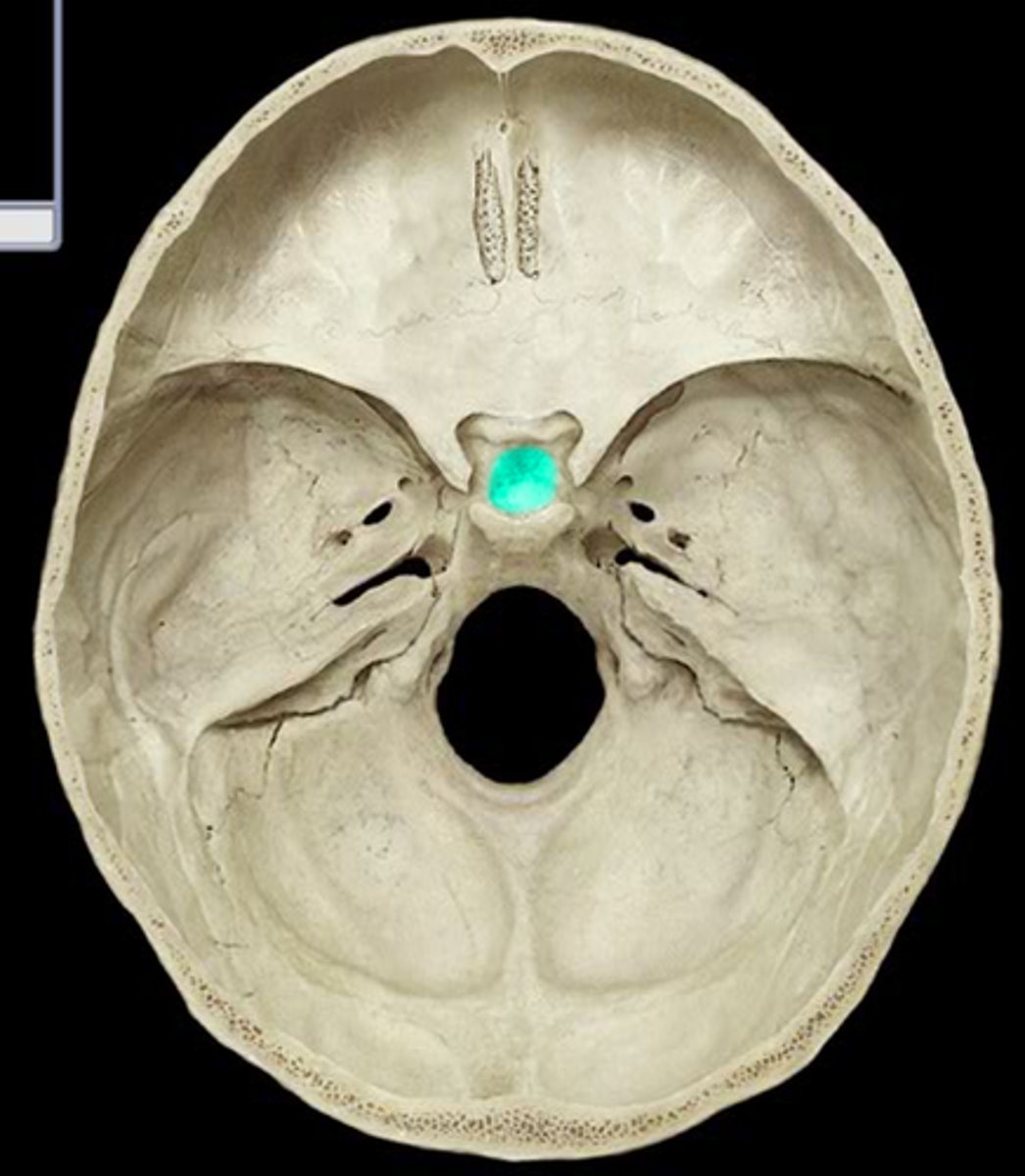 <p>depression in the center of the sella turcica</p>