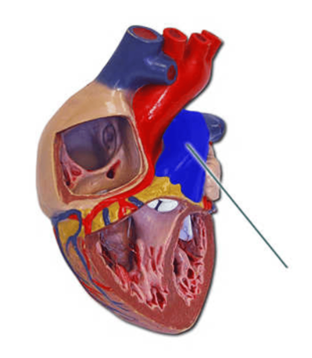 <p>pulmonary trunk</p>