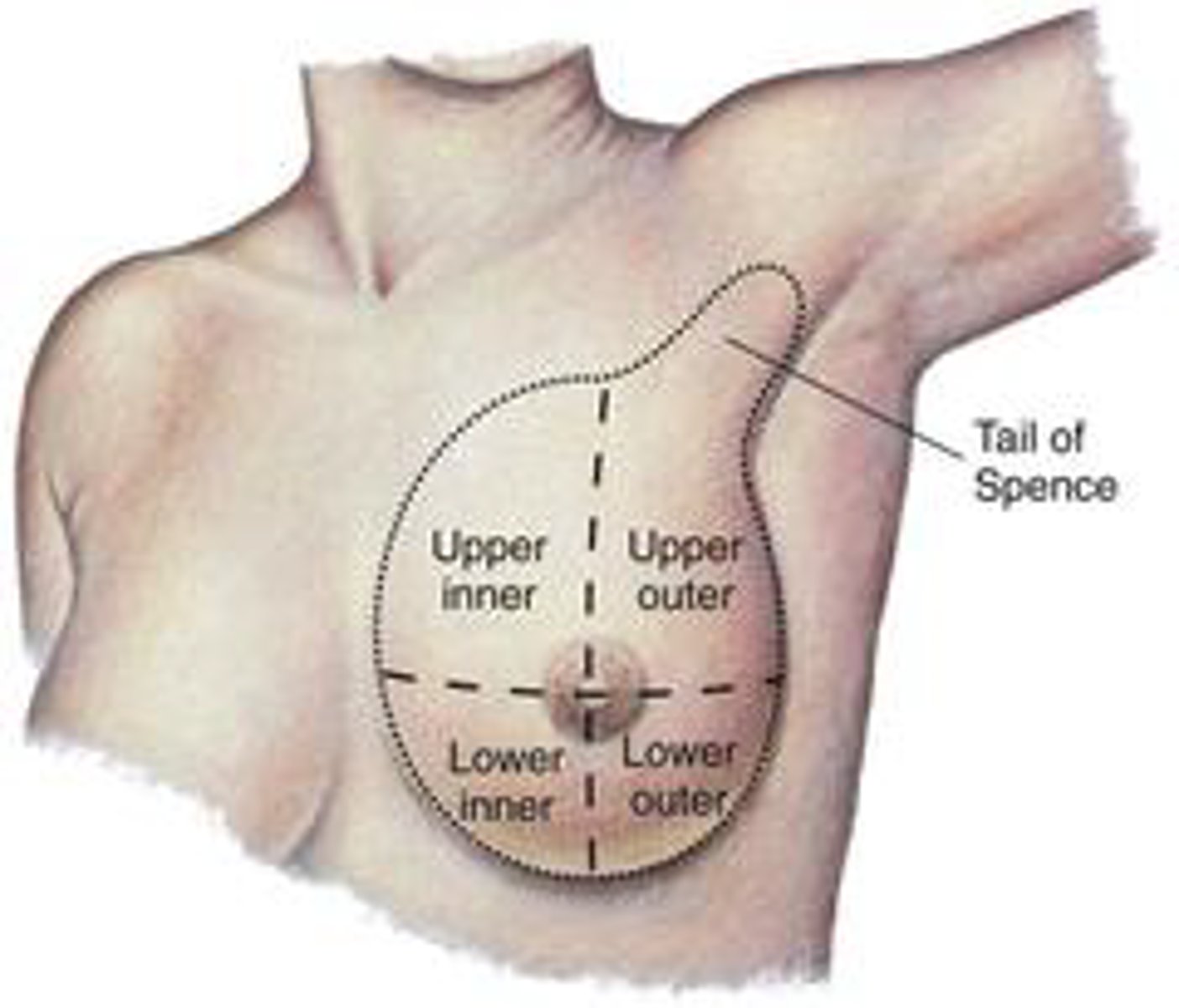 <p>An extension of breast tissue into the axilla; the most common site for breast cancer.</p>