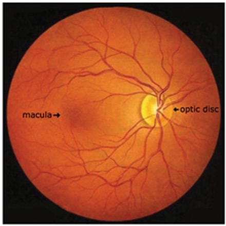 <p>area behind optic disc that is specialized for high-acuity vision </p>