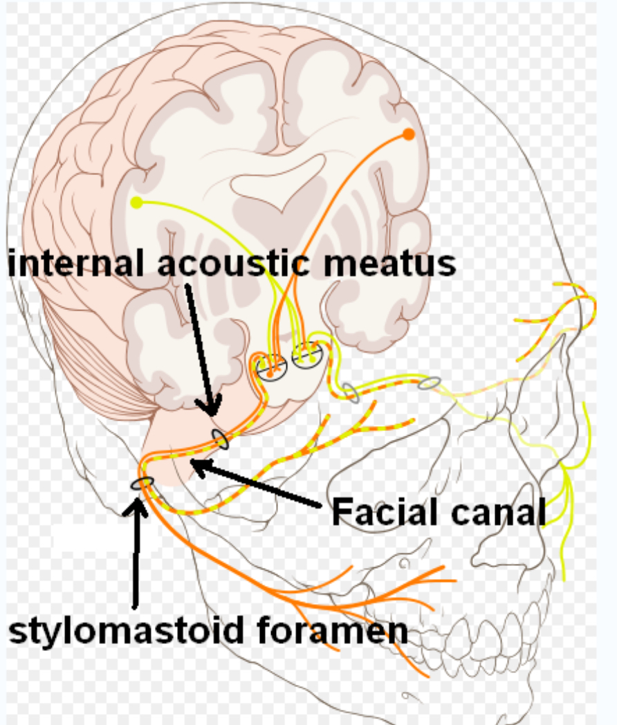 <p>CN VII, goes through internal auditory meatus</p>