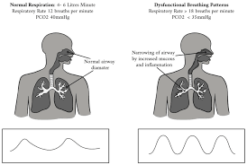 <p>rapid deep breathing</p>