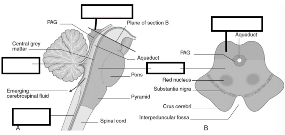 <p>Benoem de aangeduide delen van het mesencephalon</p>