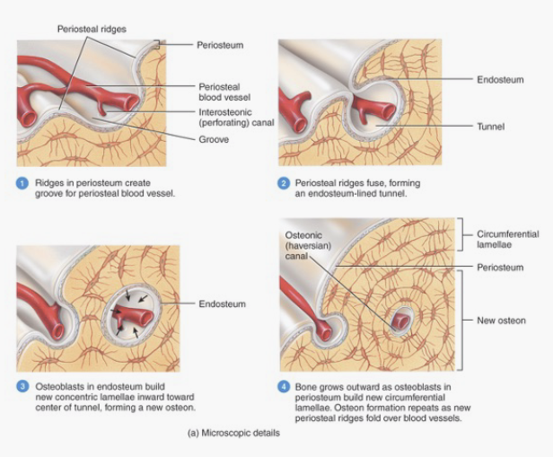 <ol><li><p>Osteoblasts on the periosteum form new bone tissue — ridges develop around periosteal capillaries that grow and fuse into a tunnel around the blood vessels</p></li><li><p>Osteoblasts in the endosteum of those canals build new <strong>concentric lamellae</strong> toward the tunnel which forms a new <strong>osteon</strong></p></li><li><p>Osteoblasts in the periosteum build new <strong>circumferential lamellae</strong> furthering the outward growth</p></li><li><p>Osteoclasts on the inside of the bone break down tissue, widening the medullary cavity</p></li></ol>