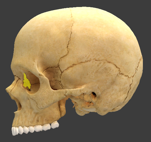 term image