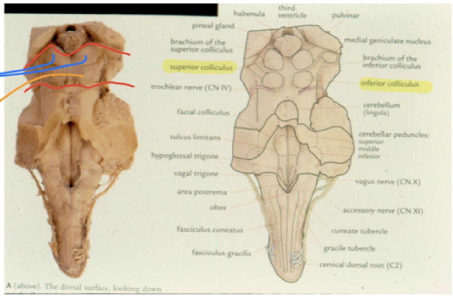 <p>1. superior colliculi (right and left)</p><p>2. inferior colliculi (right and left)</p>